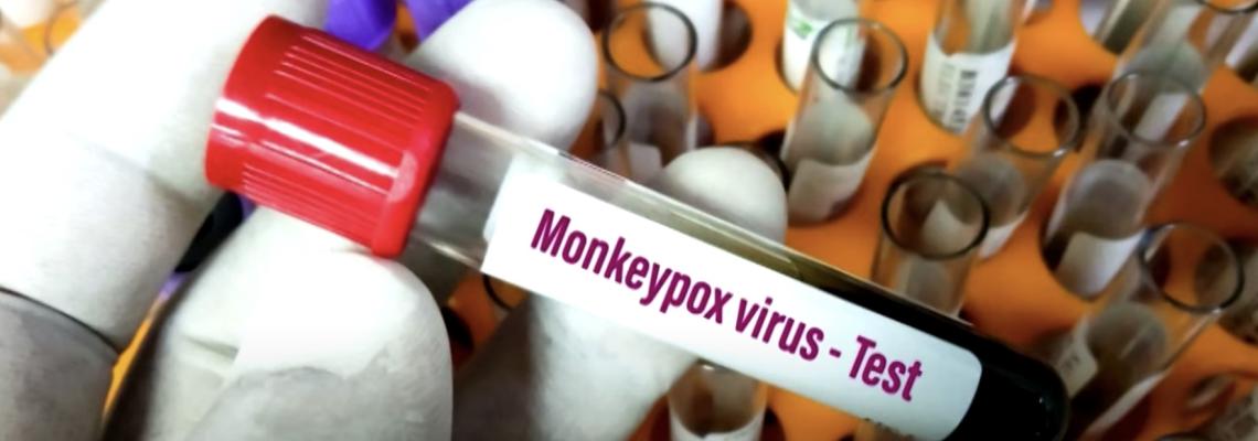 Tout savoir sur la variole du singe